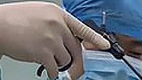 Imagen de las bolas magnéticas en el pene del menor.