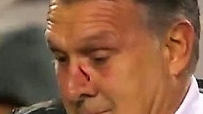 El 'Tata' Martino recibió un balonazo en el México-Paraguay.