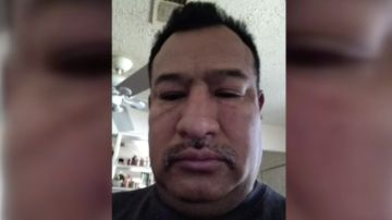 Medina le envío a su esposa un foto de su rostro tras la pelea.