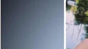 Cirujano pechos implantes