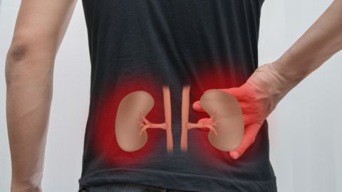 cáncer de riñón