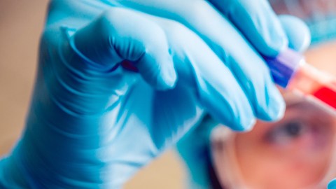 cáncer en la sangre