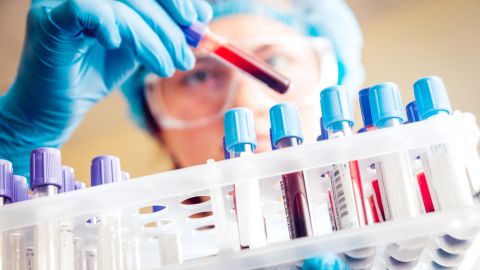 cáncer en la sangre