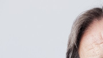 retinopatía diabética