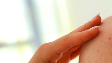 El sarampión puede tener complicaciones graves en los adultos.