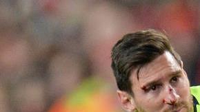 Messi terminó con el rostro lleno de sangre, por un manotazo de Christopher Smalling