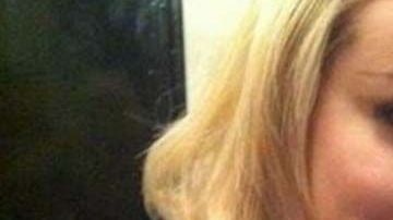 Hornby sufre de macromastía o gigantomastia juvenil.