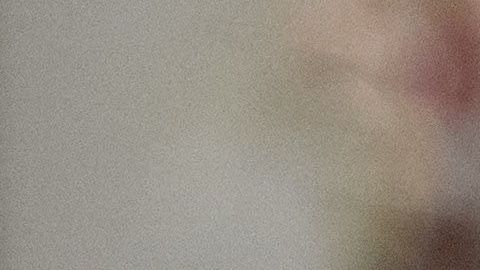 Reconocido psicólogo da ejemplos de los síntomas de Trump