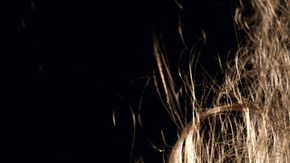 Cuando el problema es mayor o si sencillamente deseas eliminarlo desde los inicios, puedes seleccionar uno de los muchos tratamientos que actualmente existen.