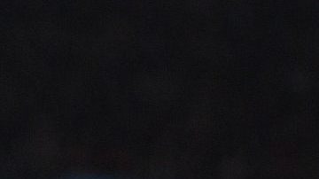 El jugador del Barcelona Luis Suárez será intervenido de la rodilla derecha.