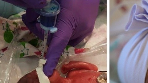Imágenes del video publicado por el Hospital Sharp Mary Birch.