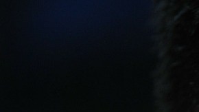 desprendimiento retina