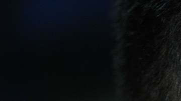 desprendimiento retina