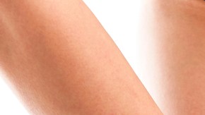 celulitis piernas