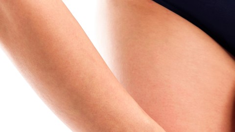 celulitis piernas