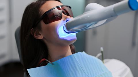 blanqueamiento dental
