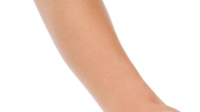 labioplastia