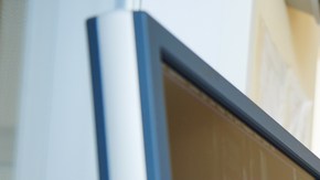 malformación de chiari