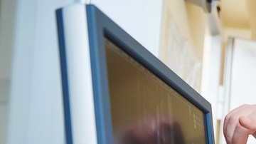 malformación de chiari