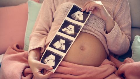 control prenatal