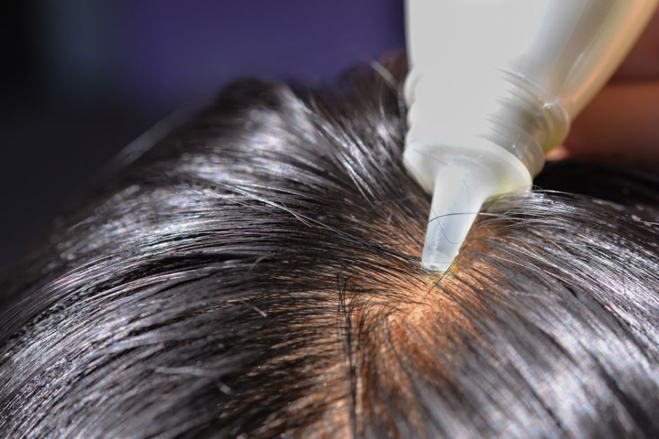 como acelerar el crecimiento del cabello