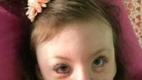 Sophia padecía el síndrome Rett y fue insultada en redes sociales.