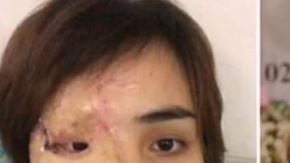 Jamás se imaginó que sería atacada por quien creía era el amor de su vida.