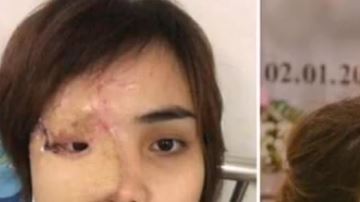 Jamás se imaginó que sería atacada por quien creía era el amor de su vida.