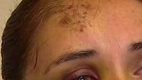 Berónica Ruiz tras el ataque