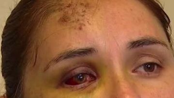 Berónica Ruiz tras el ataque