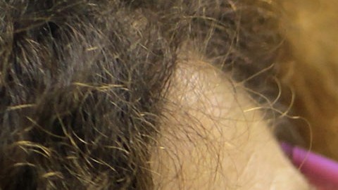 Diversos métodos han sido desarrollados para detectar tipos de cáncer de piel.