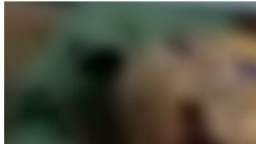 Los médicos aseguran que este hombre sobrevivió de milagro.