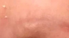 El niño fue contagiado del virus del herpes simple.