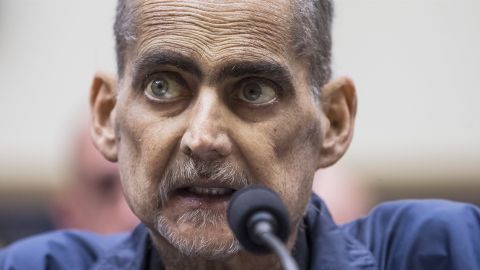 Luis Álvarez tiene cáncer y lleva 69 rondas de quimioterapia.