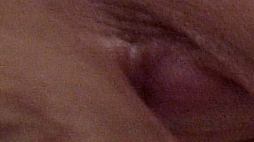 Pastillas de OxyContin.