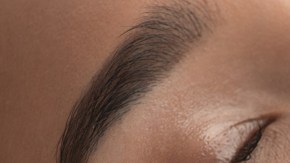 Con el ácido hialurónico se consigue atracción y retención de agua en los tejidos, así como una lubricación de las articulaciones.