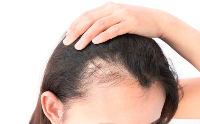 Cuál es el mejor tratamiento para hidratar y fortalecer cuero cabelludo? - La Opinión