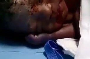 Este bebé fue hallado en la basura de un hospital chino.