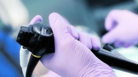 endoscopia