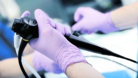 endoscopia