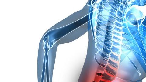 artritis