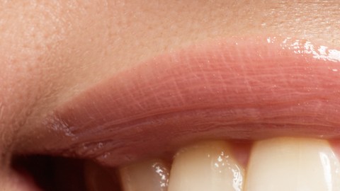 blanqueamiento dental