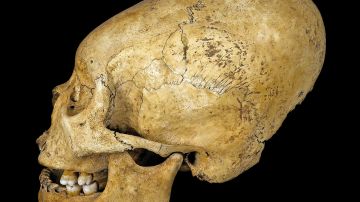 Las deformaciones de cráneo son conocidas por los antropólogos.