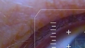 ojos-cirugia