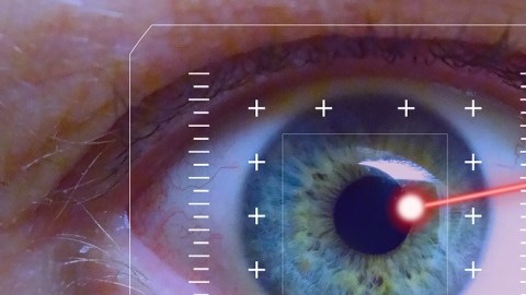 ojos-cirugia
