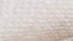 Pajarito herido fue llevado en Uber al veterinario.