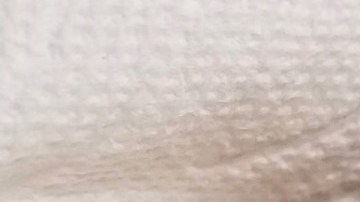 Pajarito herido fue llevado en Uber al veterinario.