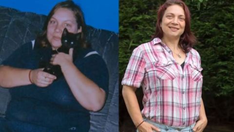 El antes y después de Dawn Chappell.