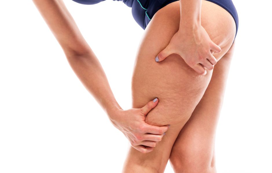 productos para quitar las celulitis