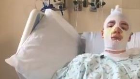 El joven sufrió quemaduras hasta de 4° grado.